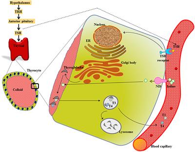 Molecular Insights Into the Relationship Between Autoimmune Thyroid Diseases and Breast Cancer: A Critical Perspective on Autoimmunity and ER Stress